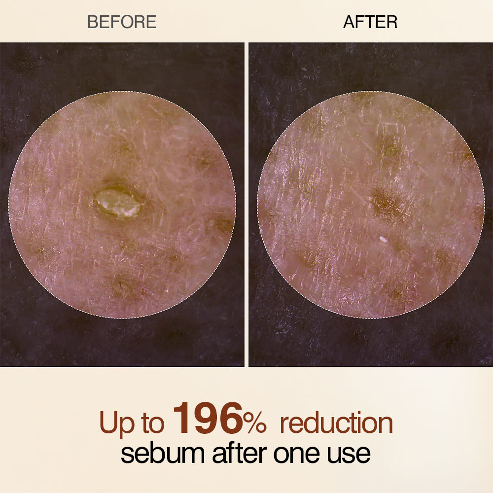 Korean version of Miora exfoliating second-generation