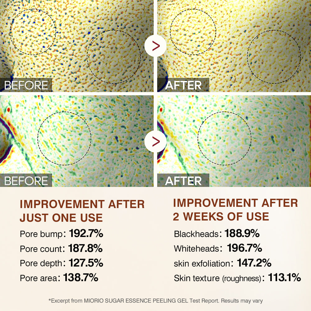 Korean version of Miora exfoliating second-generation